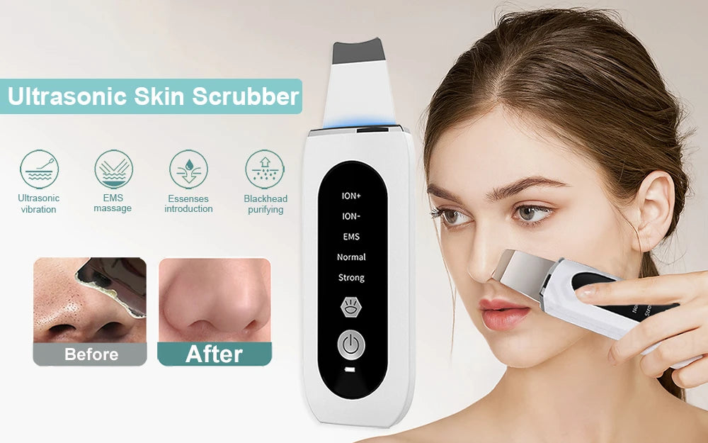 Ultrasonic Skin Scrubber & Blackhead Remover