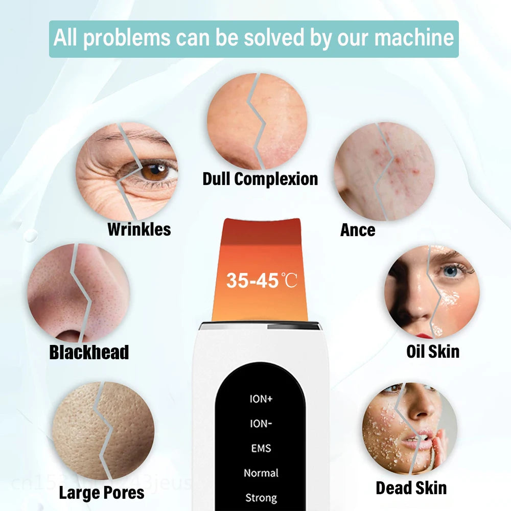 Ultrasonic Skin Scrubber & Blackhead Remover