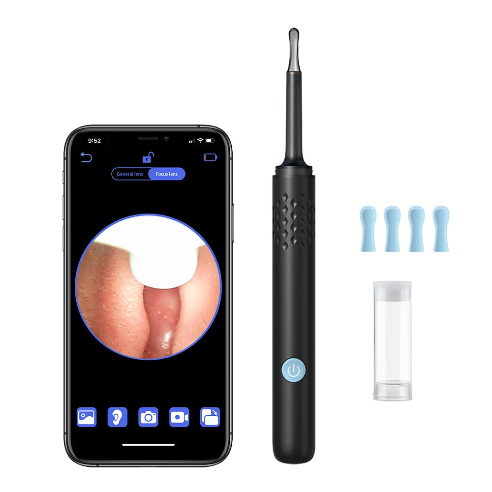 Smart Visual Ear Cleaner with HD Camera