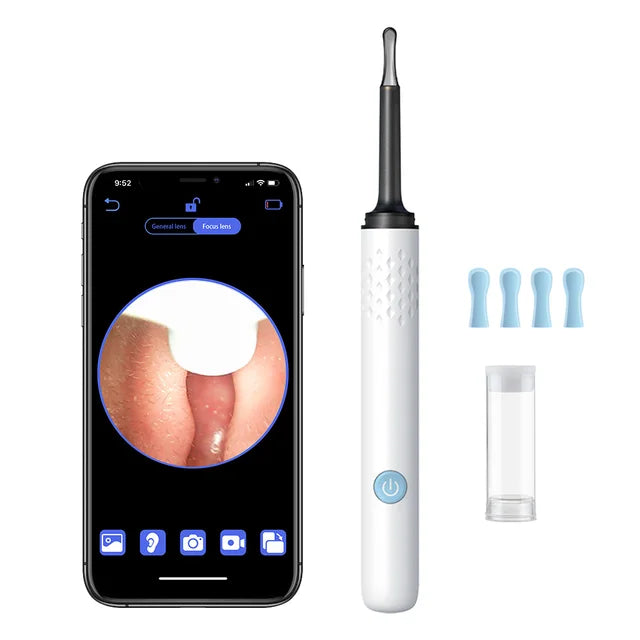 Smart Visual Ear Cleaner with HD Camera