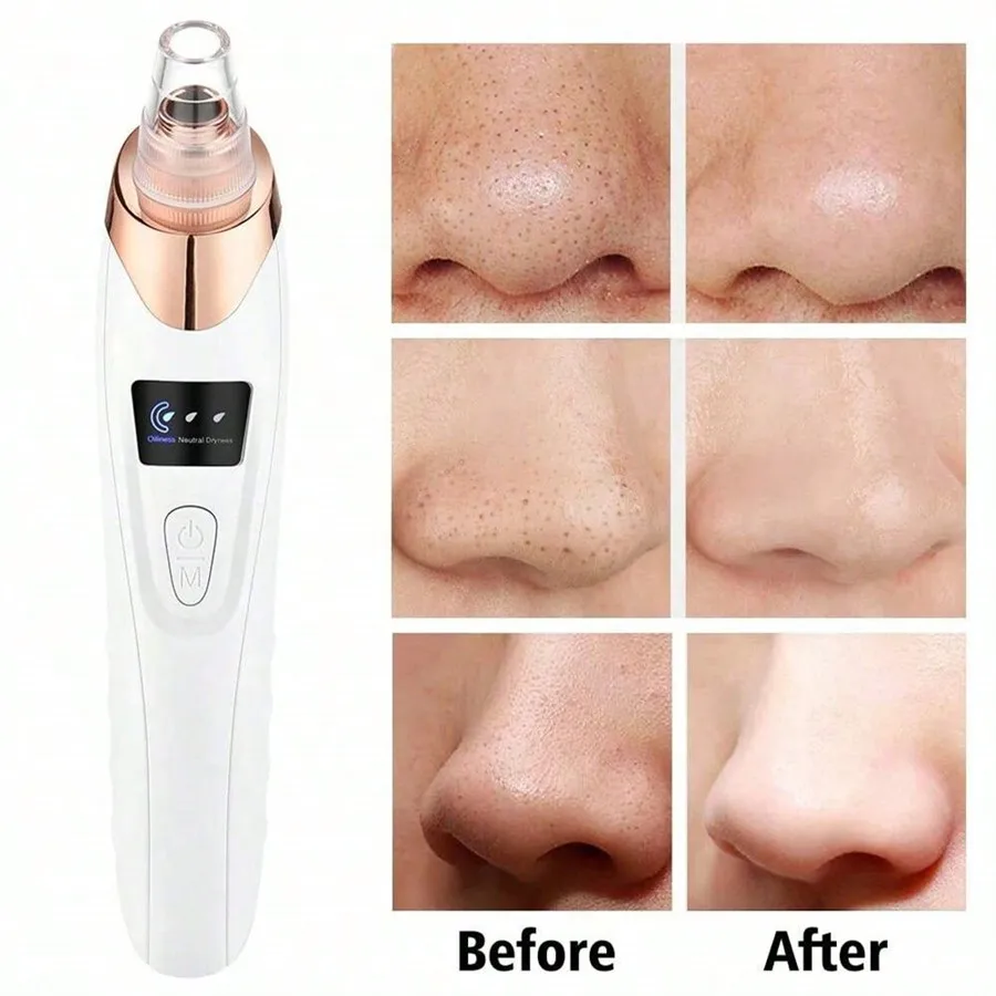 Facial Pore Vacuum for Blackhead & Acne Care