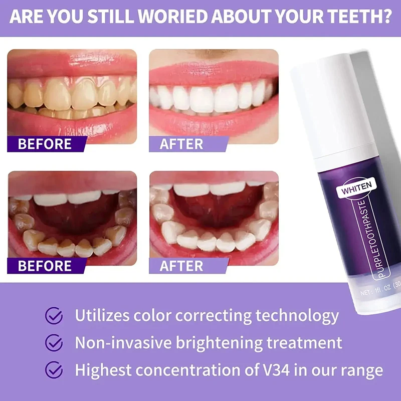 5D Teeth Whitening Stick for Bright and Fresh Smile (30ML)