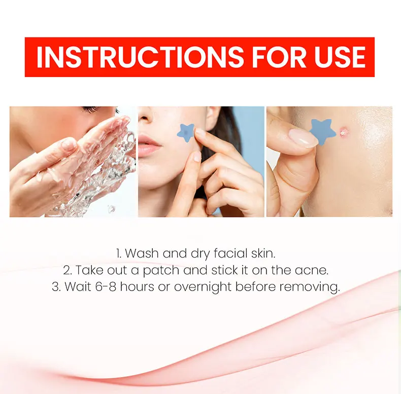 200x Acne Repair Patches for Clear Skin