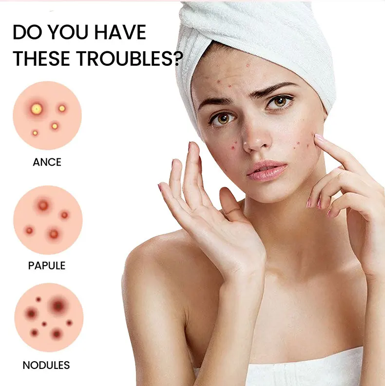 200x Acne Repair Patches for Clear Skin