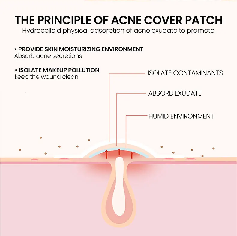 200x Acne Repair Patches for Clear Skin