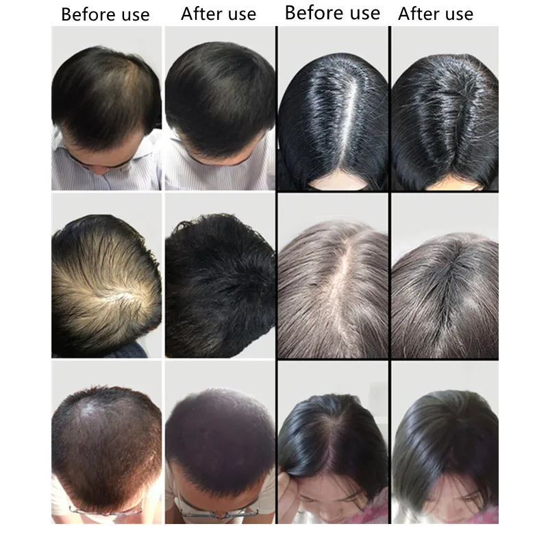 Hair Powder Spot Filler