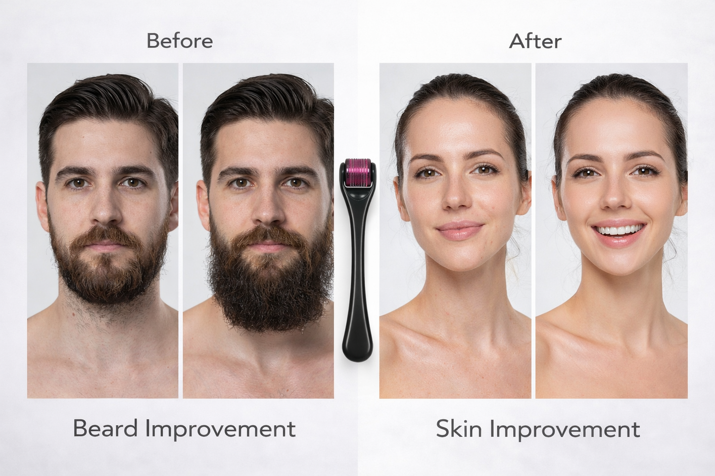 Derma Roller for Hair & Beard Growth 0.3mm