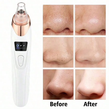 Facial Pore Vacuum for Blackhead & Acne Care