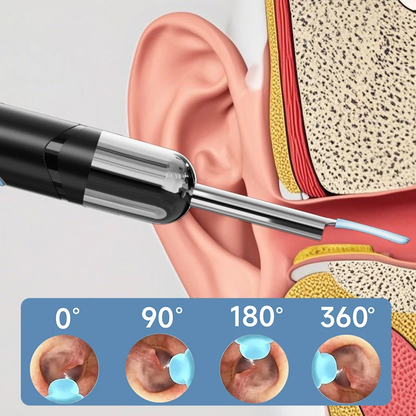 Smart Visual Ear Cleaner with HD Camera