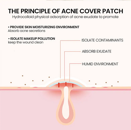 200x Acne Repair Patches for Clear Skin